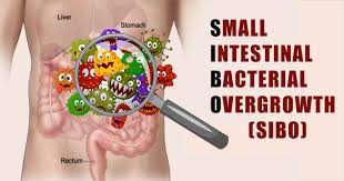 SIBO (small intestinal bacterial overgrowth)