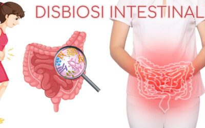 Disbiosi e test del microbiota
